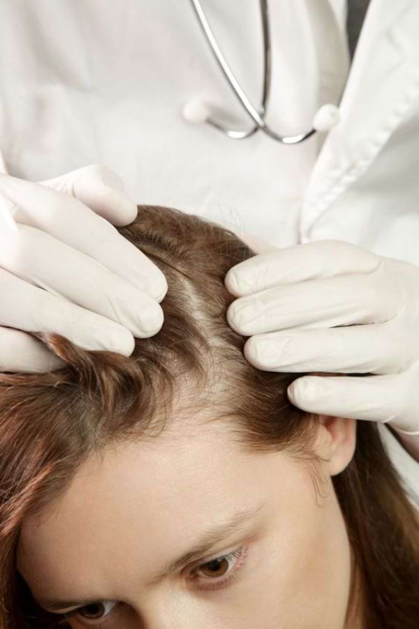 DIY-Haarkuren als Hausmittel gegen Trockene Kopfhaut
